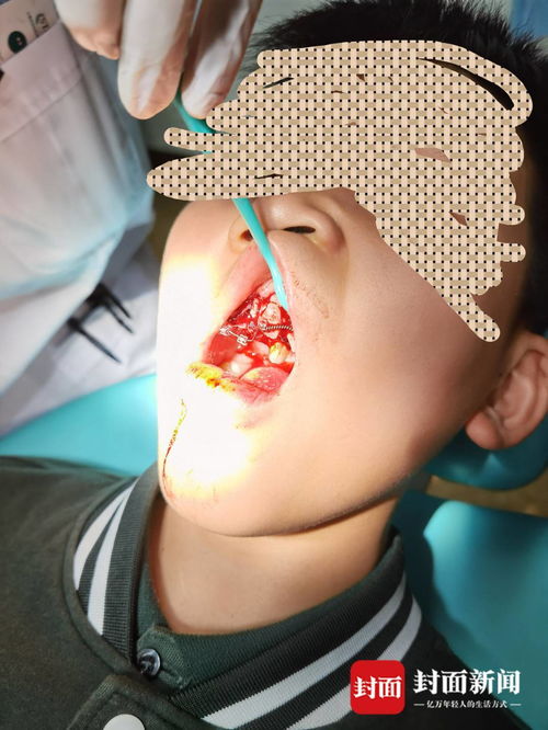 重慶特斯拉車主遭遇驚魂一幕 停車時(shí)車輛自動(dòng)加速撞墻，致孩子受傷